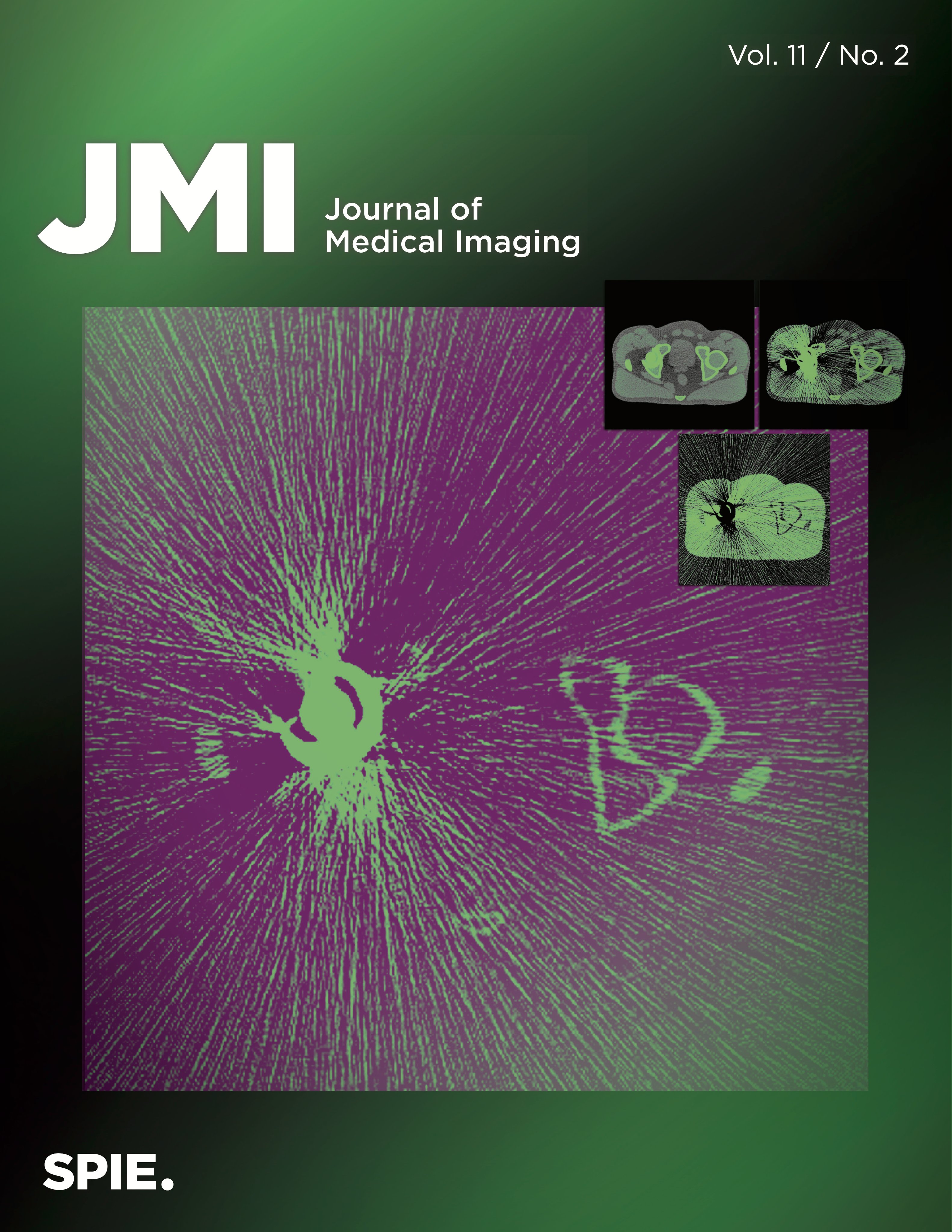 MV-kV dual-energy imaging on the cover of JMI.