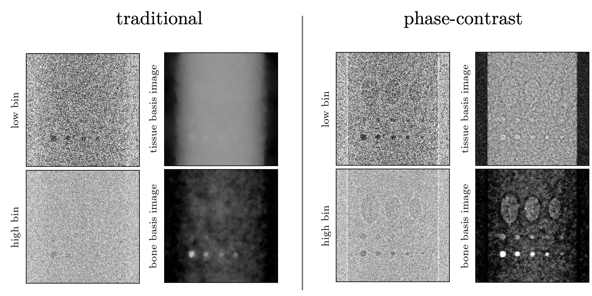 Spectral X-ray phase-contrast material decomposition