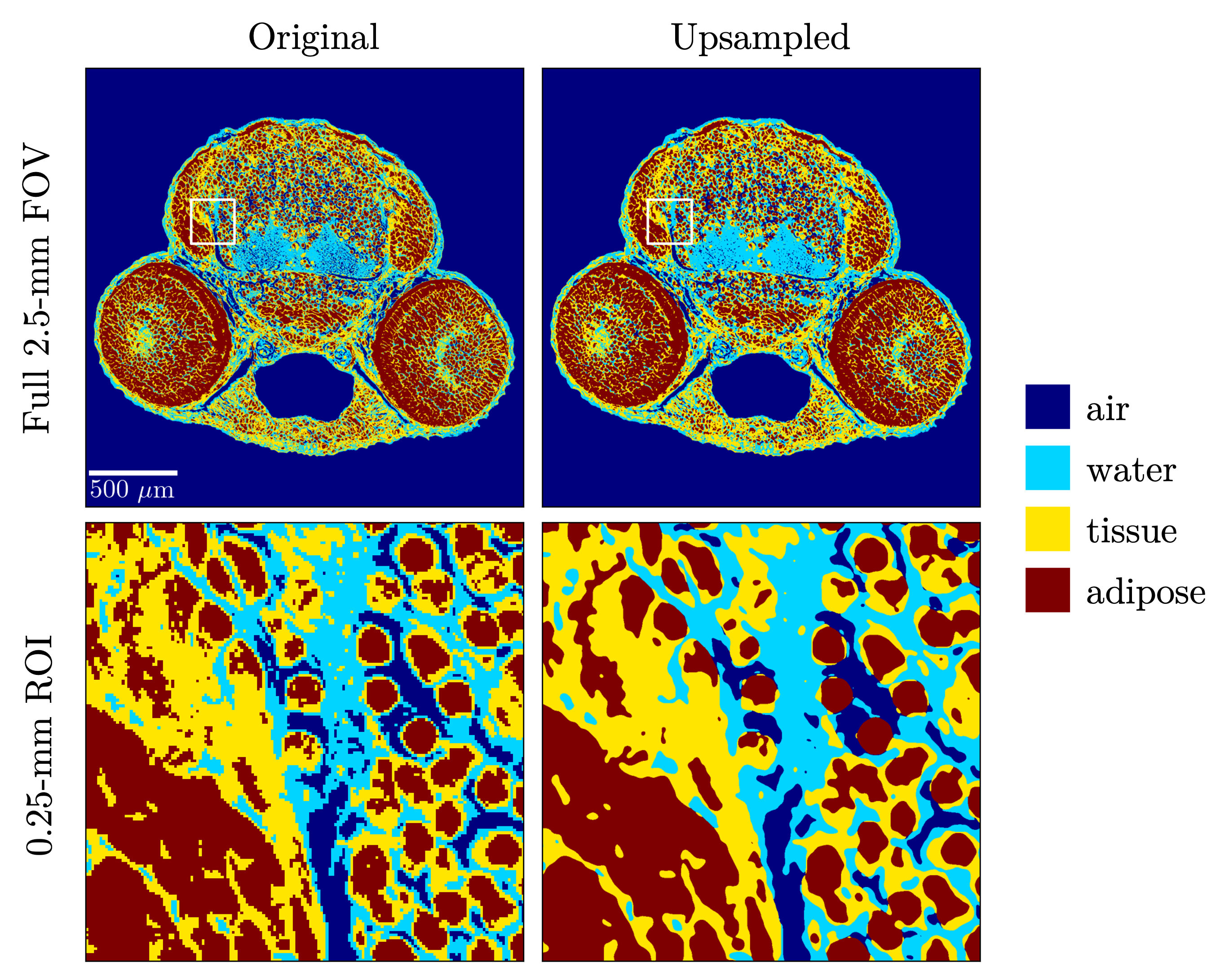 High-resolution phase-contrast micro-CT simulation